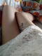 Leg